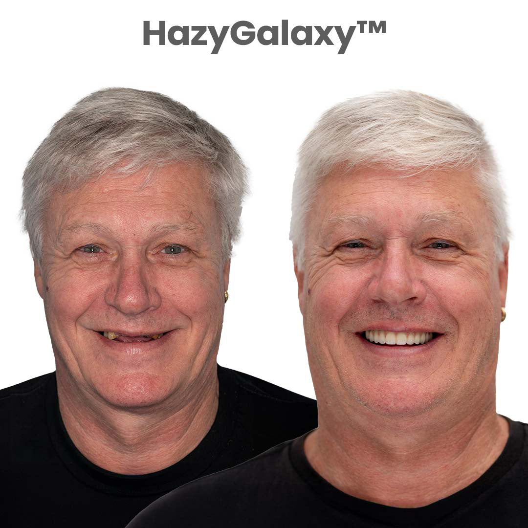 ⏰⏰ HazyGalaxy™ Custom-Fit Dentures ⏰ ENDS TODAY 70% OFF | Smile with Confidence