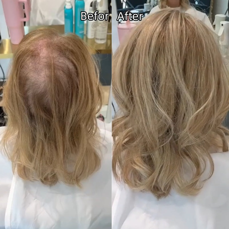 🇺🇸 Final Hours – 58% OFF | Lightweight & Breathable Wavy Hair Topper ✨ Natural Volume, Everyday Confidence